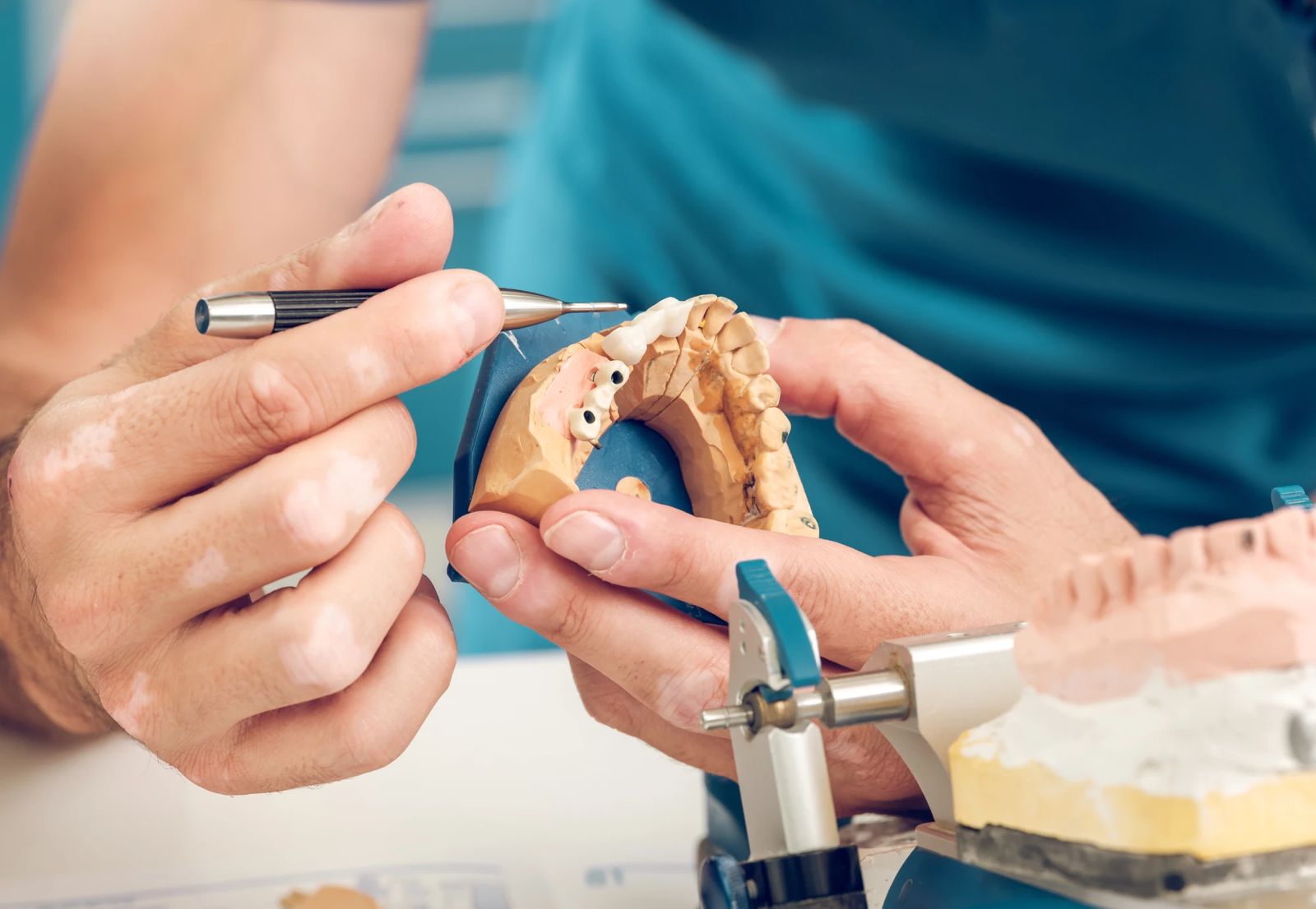 Un odontotecnico al lavoro su un modello di protesi